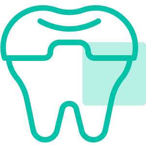 Teeth Implants